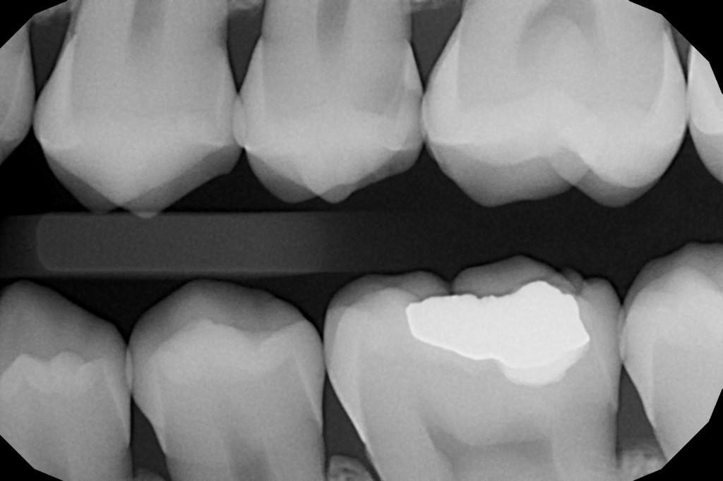 Vstupní vyšetření