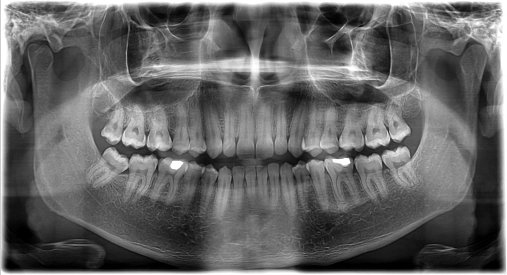 Vstupní vyšetření