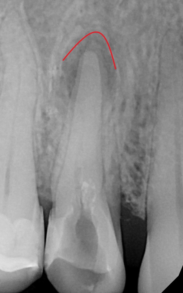 Vstupní vyšetření